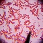 bacteria lyme symptoms
