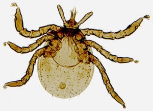 Babesia and Lyme Symptoms