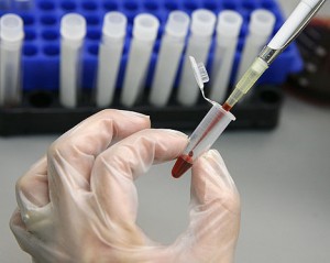 Advanced Labs Lyme symptoms