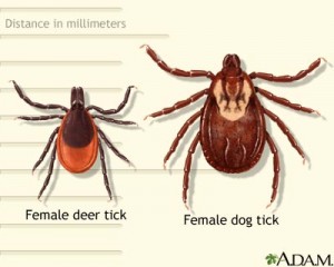doctors and lyme disease and lyme symptoms